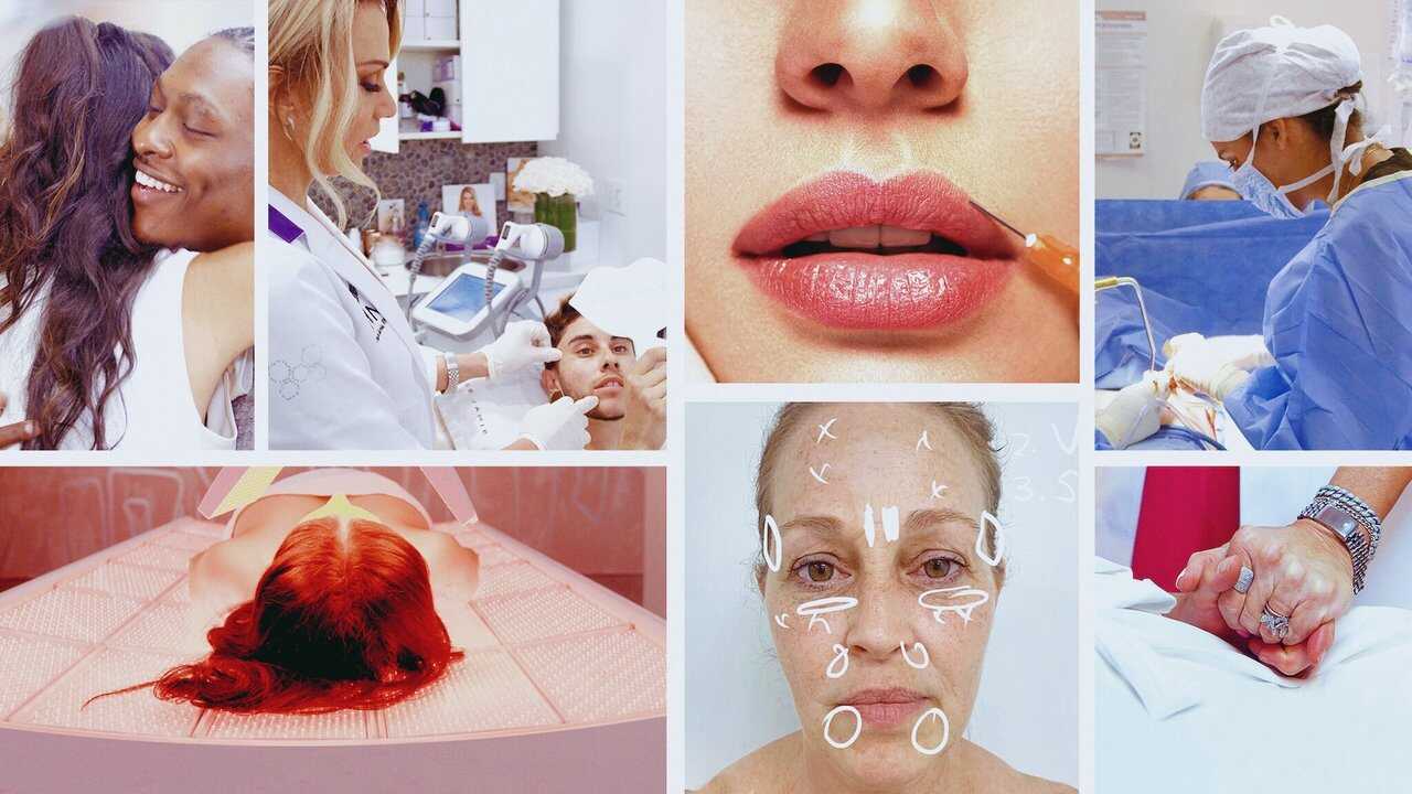FR - Skin Decision: Before and After 0